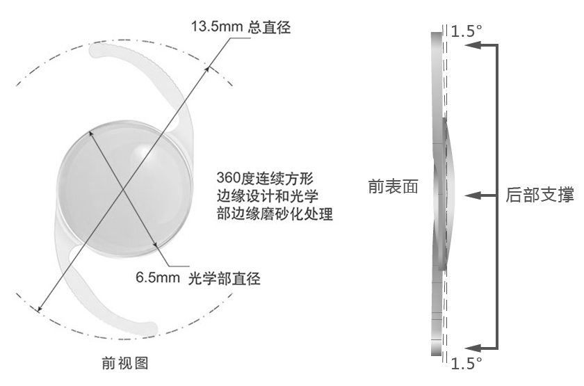 Proming普諾明大光學(xué)區(qū)高次非球面人工晶狀體ALD